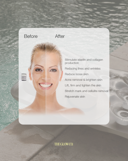 Radio-frequency (RF)