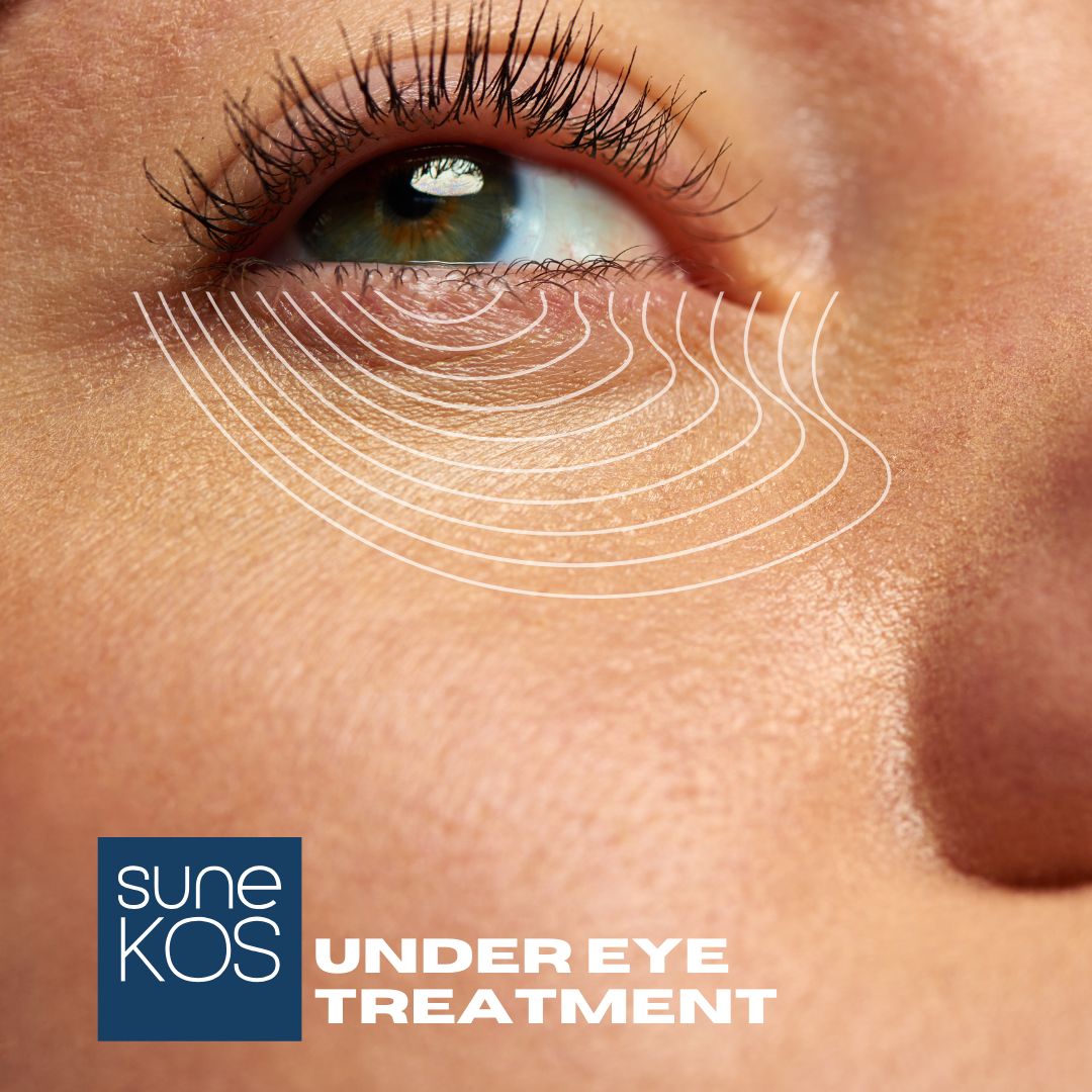 Skin booster Undereye