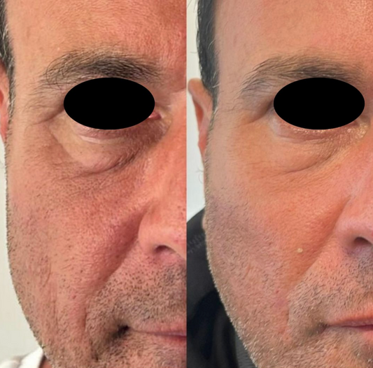 Polynucleotide - Nucleofill
