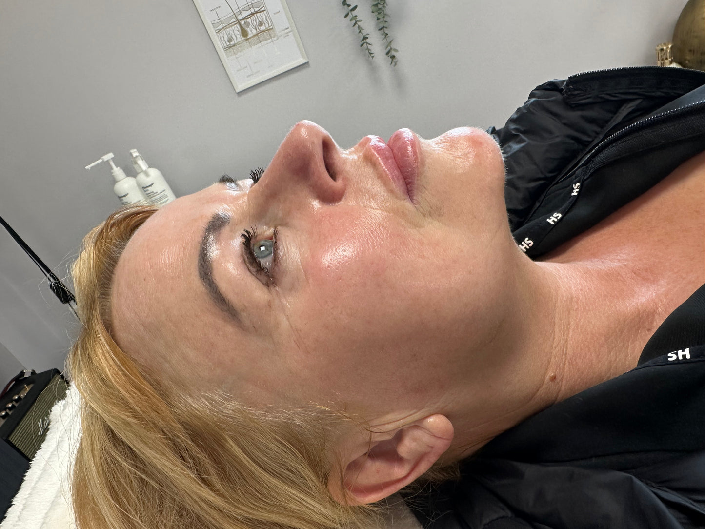 Hydra-facial and Skin booster